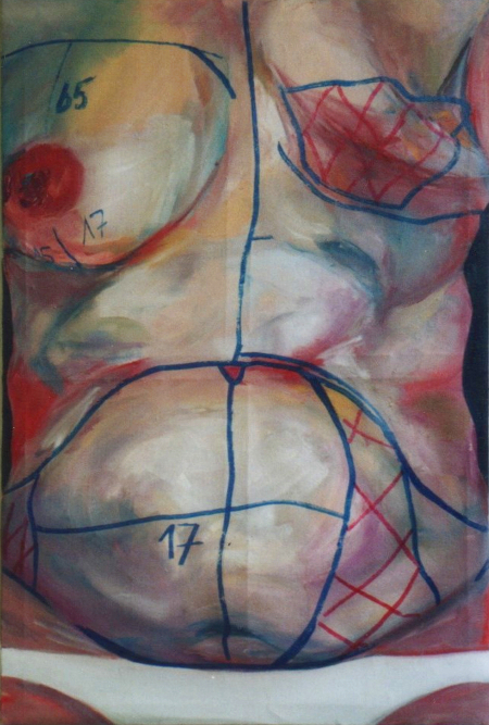 weiblicher Torso mit Zeichnungen vor einer Schönheitsoperation